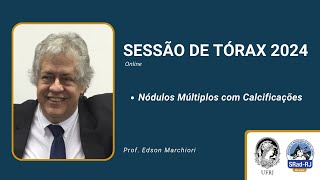 Sessão de Tórax 13/03/2024 - Nódulos múltiplos com calcificações screenshot 1