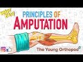 Amputation principles  animation  basics  neet pg  amputee  the young orthopod