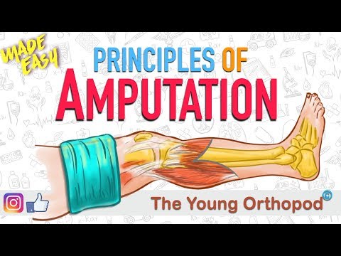 Video: Amputation I - Glossary Of Medical Terms