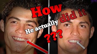 Ronaldo Leaked Video How He Whitened His Teeth,