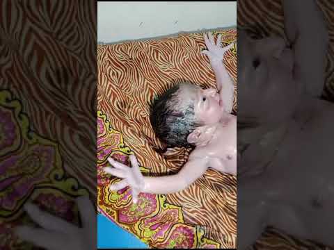 Nurse Newborn baby cleaning process of lot of vernix and ceoseoos of newborn healthy