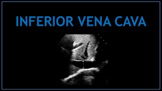 Inferior Vena Cava (IVC- Echocardiography)!