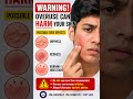 Pimples se pareshan ho? Har random cream use karna band karo ❌#Acne#skincare #acnetreatment#clinsol