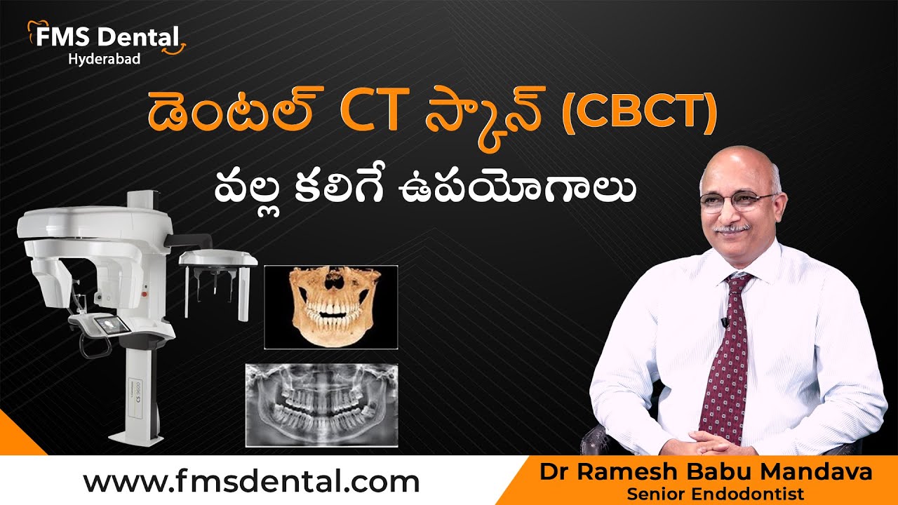 Why a CT Scan (CBCT) is Essential for Dental Treatment| 3Dscan | Dr Ramesh Babu Mandava | FMS Dental