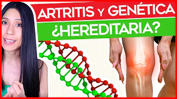 ¿La artritis reumatoide es hereditaria o genética?