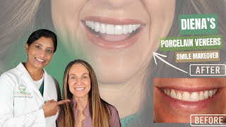 World's 87th American Academy of Cosmetic Dentistry Fellow Dentist gives a Makeover in Two Visits