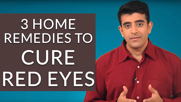 3 Effective Home Remedies To GET RID Of RED EYES