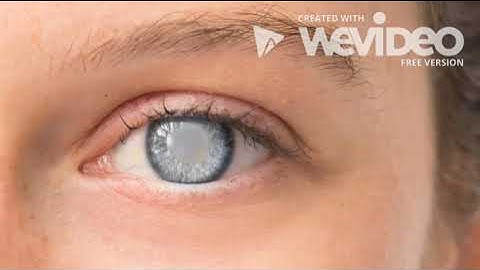 Visual Impairment Documentary