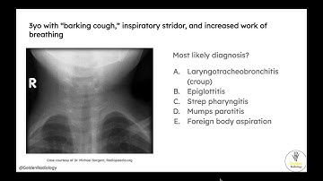 High Yield Radiology for USMLE Step 1: Pediatric Respiratory