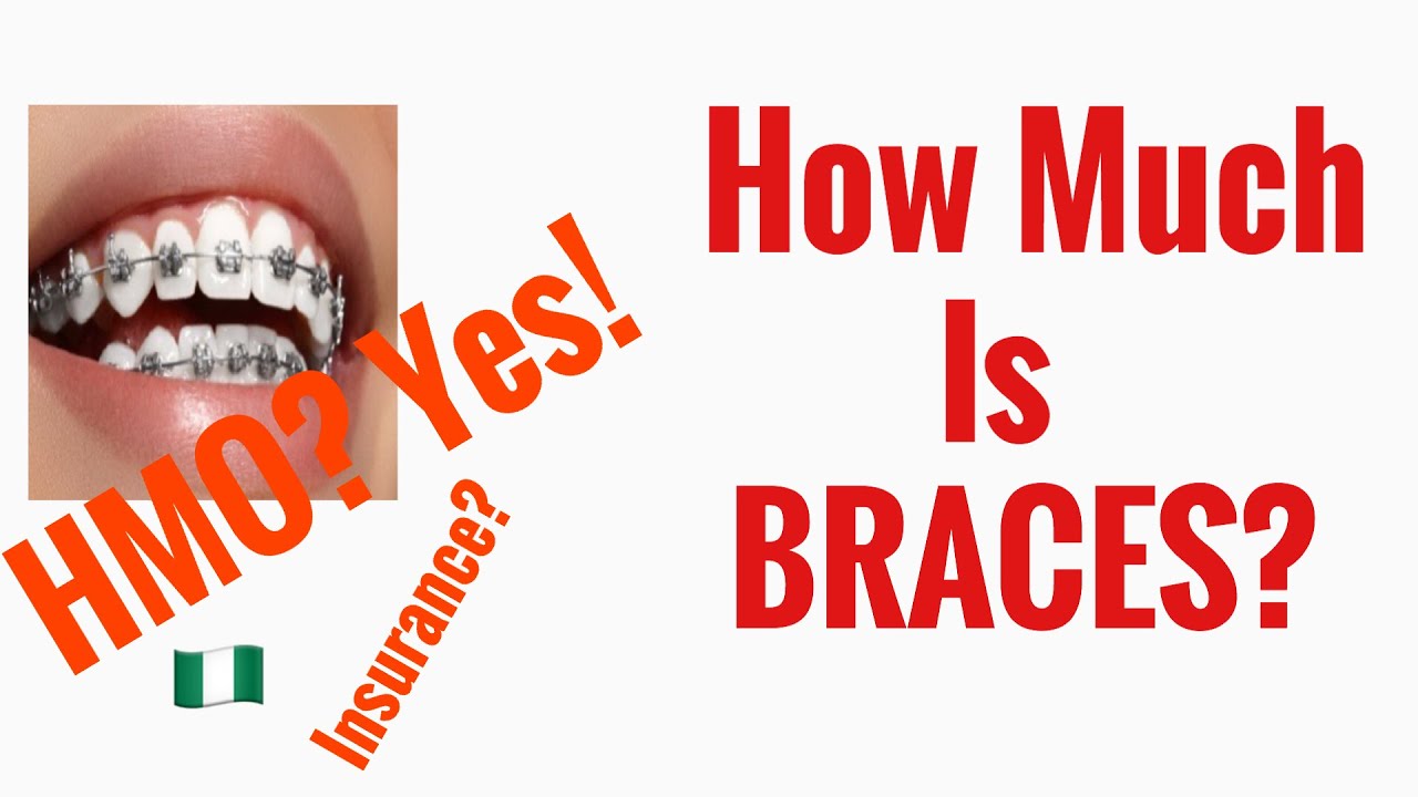How Much Do Braces Cost In Nigeria? Payment Plan|Hmo?| Installments?