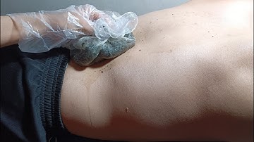 2 cách dùng hạt đu đủ chữa gai cột sống hiệu quả nhất | Papaya seeds cure spine spines