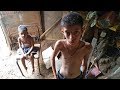 Hambre en Venezuela: el drama de la severa desnutrición infantil