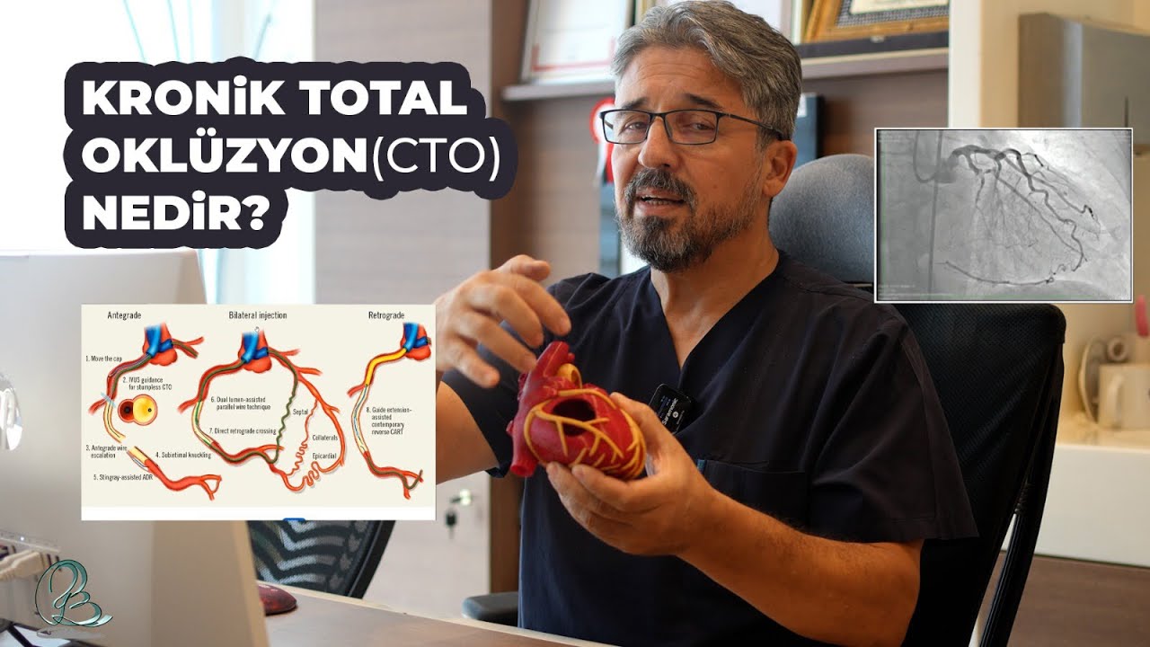 Kronik Total Oklüzyon (CTO) Nedir?