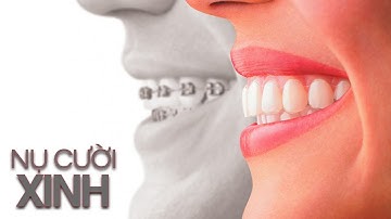 INVISALIGN - NIỀNG RĂNG BẰNG MÁNG - EP 2