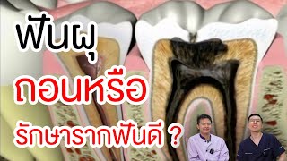 คนฟันผุทะลุถึงโพรงประสาทต้องดู !! เราจะถอนหรือรักษารากฟันดี ?  | คลายปัญหาฟันกับหมอโชค