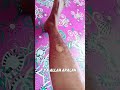 sedikit cerita awal kaki patah,tetap tenang untuk penanganan awal