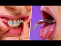 21 ﻿﻿ COOL TEETH GADGETS & HACKS THAT WILL CHANGE YOUR LIFE!