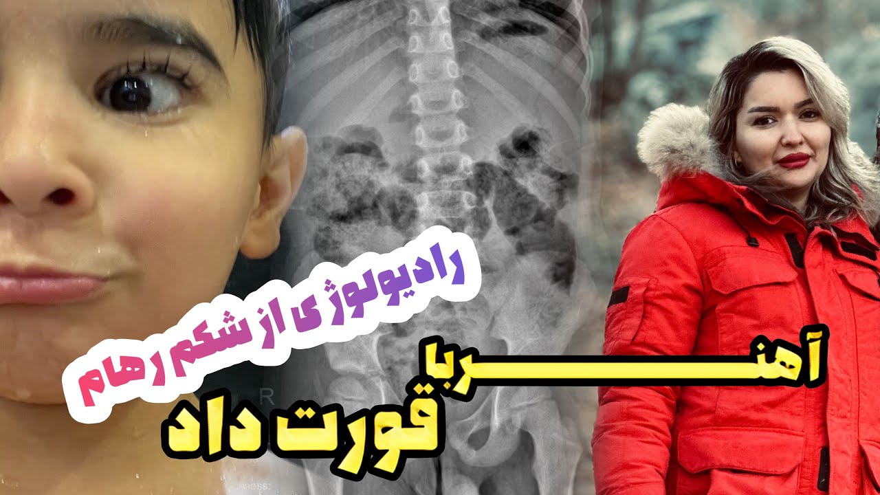 آهنربا داخل شکم رهام/آبروریزی جلو مهمان🫩😞