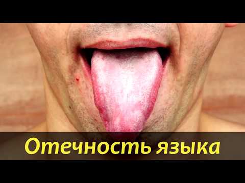 Видео: Покалывание языка: 9 возможных причин