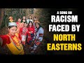 Chinky NORTHEAST UNITED Racism SONU BAROI