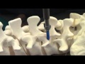 APSS Workshop Video 1 Lumbar Pedicle Screw and S1 Screw