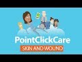 Pointclickcare skin and wound  kukuzoos