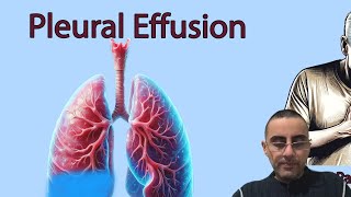 Water on the Lungs: Understanding Pleural Effusion, Causes and Symptoms