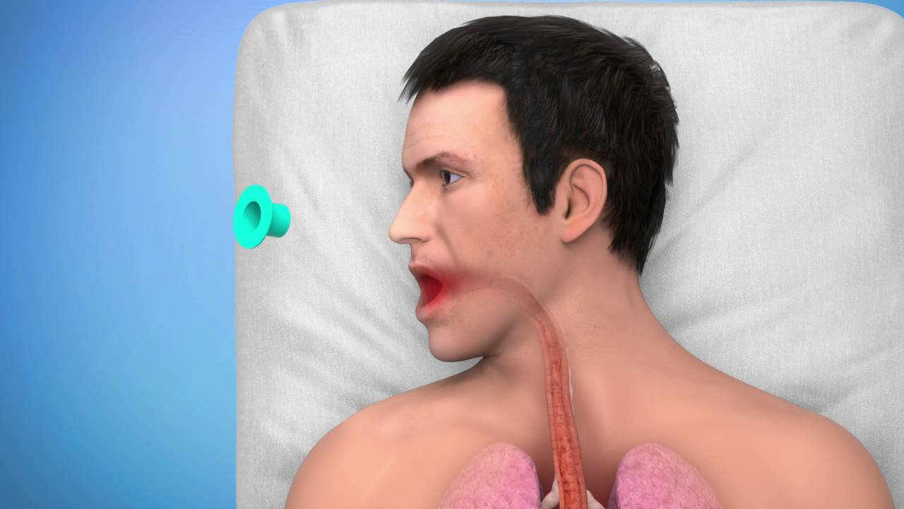 ELLA Extractor - Product Description and Procedure