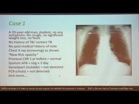 กรณีศึกษา ( Case study )  How to interpreted molecular result relevant to DR,..โดย รศ.นพ.กมล