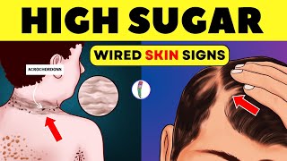 Insulin Resistance - Wired Skin Signs | Reverse insulin resistance | Diabetes mellitus