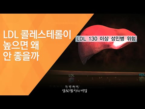 LDL 콜레스테롤이 높으면 왜 안 좋을까 - (2012.1.28_399회 방송)_아는 만큼 건강해진다, 종합건강검진