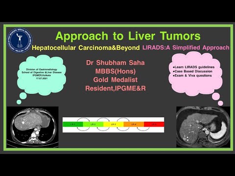 APPROACH TO LIVER TUMOR IMAGING WITH SPECIAL FOCUS TO LIRADS