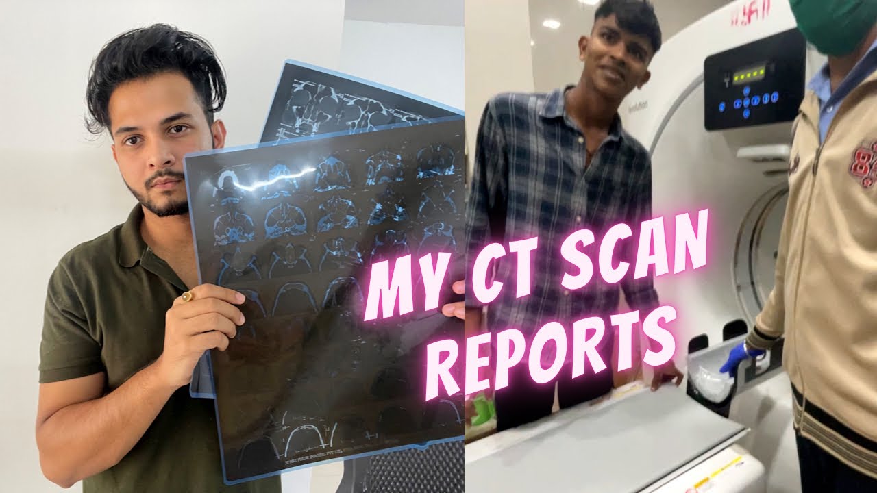 Went to Hospital for Emergency CT SCAN What happened to me? 😣 YouTube