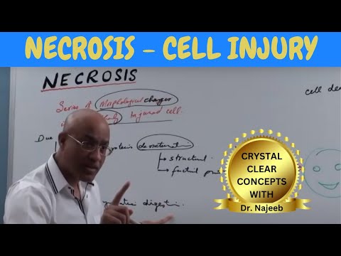 Download Necrosis - Cell Injury - General Pathology