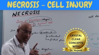 Necrosis | Cell Injury | General Pathology