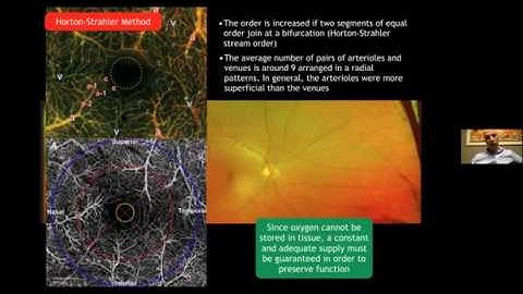 Curso OCT y OCT-A - Módulo 5