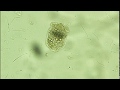 Echinococcus granulosussheep protoscolex