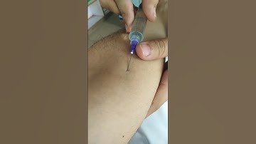 IV injection