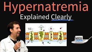 Hypernatremia Explained Clearly  Pathophysiology & Treatment