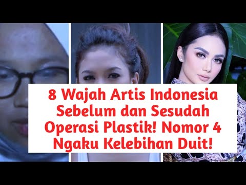 8 Wajah Artis Indonesia Sebelum dan Sesudah Operasi Plastik! Nomor 4 Ngaku Kelebihan Duit!
