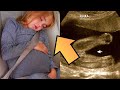 Esta Chica De 6 Años Estaba Embarazada En la Escuela, Hasta Que El Medico Descubrió Esto 😨