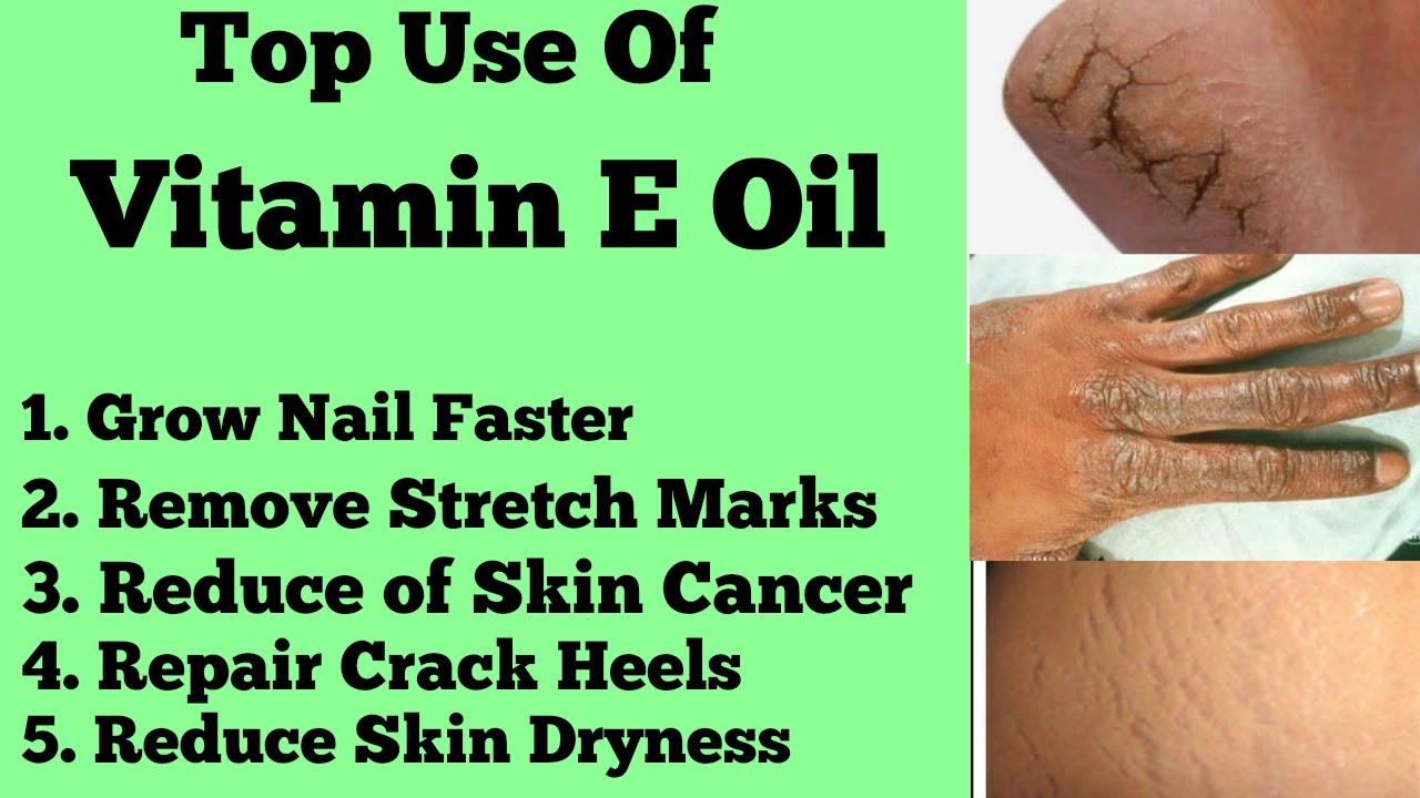 Top 5 Uses Of Vitamin E Capsule For Body Care Body Care Tips Benefits Of Vitamin E Capsule