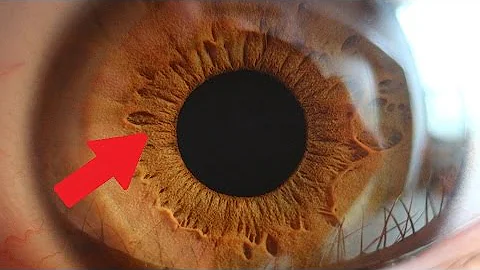 ¿Crece el ojo humano?