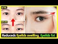 How to Reduce Eyelids swelling & Eyelids fat make Eyes bigger naturally (Japan Eyes Massage)