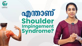എന്താണ്  Shoulder Impingement Syndrome? | Cortex Pain Care