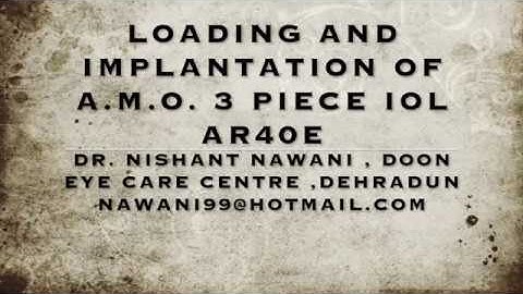 AMO Sensar 3 Piece IOL (AR40e) Loading and Insertion