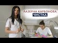 Лазерна карбонова чистка