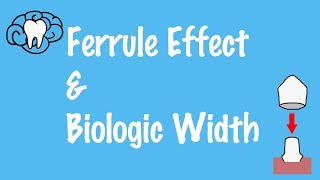Ferrule Effect and Biologic Width