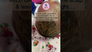 How to get rid of CRADLE CAP on baby's scalp naturally screenshot 3