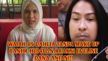 Wajah Iis Dahlia Tanpa Makeup Dihuj@t, Eveline Nada Anjani: Enggak Seharusnya Menghina Fisik Orang!
